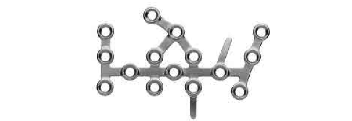 П’яткова пластина